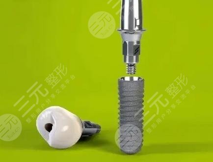 种植牙齿的位置和种类