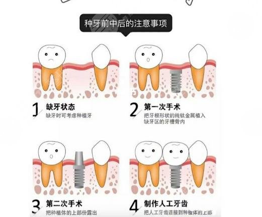 卫生方面