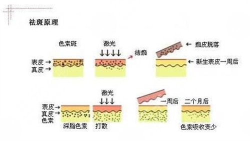 2024成都二医院皮肤科祛斑价格表|医生专家|祛斑前后对比图