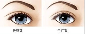 美杜莎双眼皮术前准备事项有哪些?