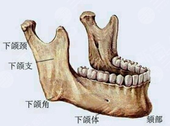 下颌角整形