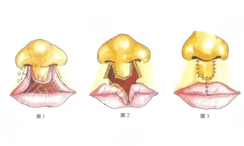 医院的因素：