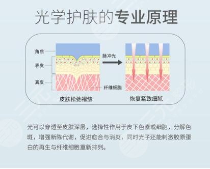 做光子嫩肤的注意事项