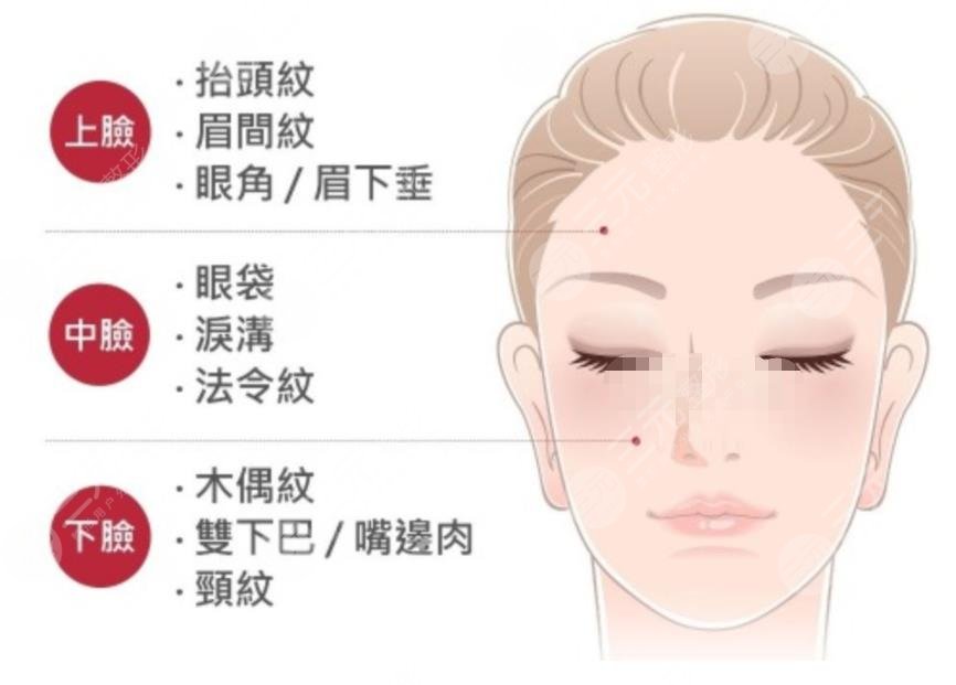 面部拉皮除皱手术有哪些优势呢?