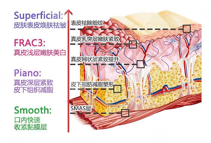 欧洲之星4d到底是什么