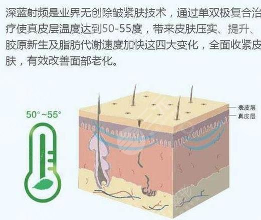 深蓝射频和光子嫩肤哪个好?