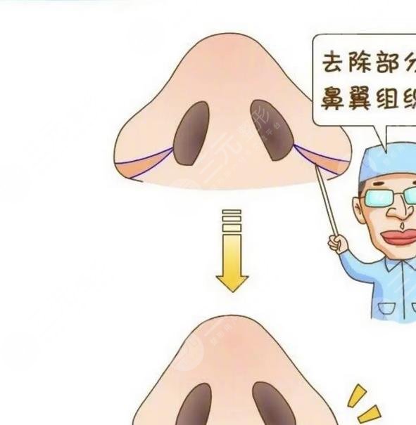 鼻头大怎么办