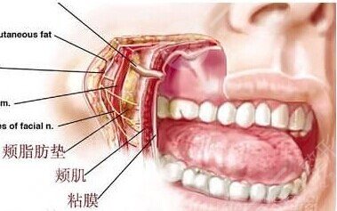 颊脂垫手术有什么危害吗?