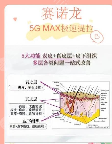 赛诺龙5gmax作用原理