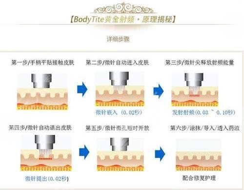 钻石和黄金微雕区别