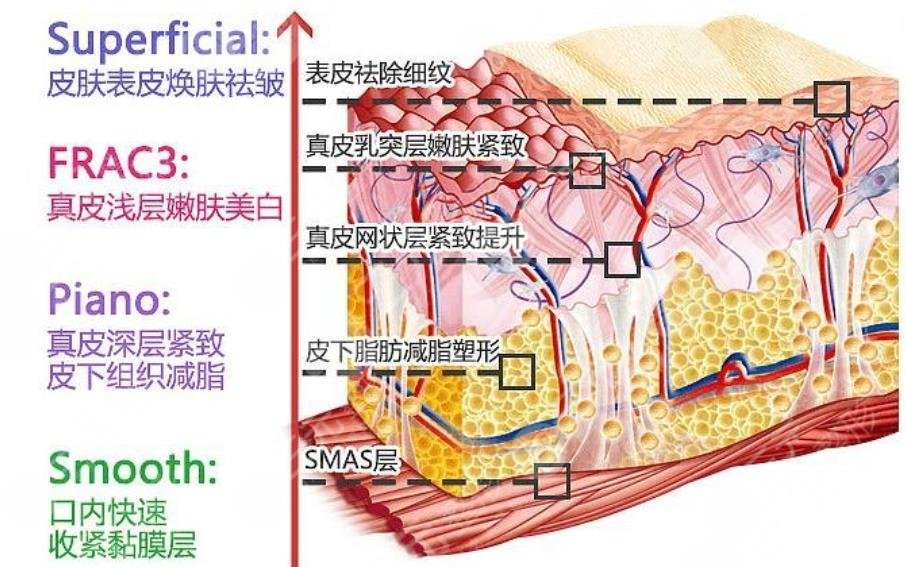 欧洲之星4d