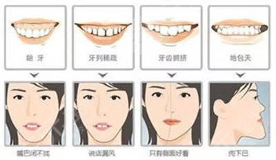 安贞医院口腔科牙齿矫正案例